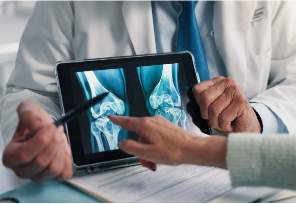 Osteoporosis y metástasis óseas: Wyost® y Jubbonti® amplían las opciones para pacientes en riesgo